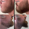 dermaroller-for-beard-before-and-after
